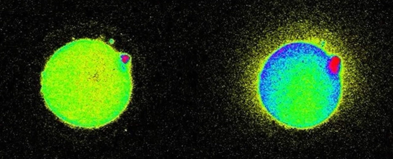 Human eggs produce sparks at the exact moment of conception